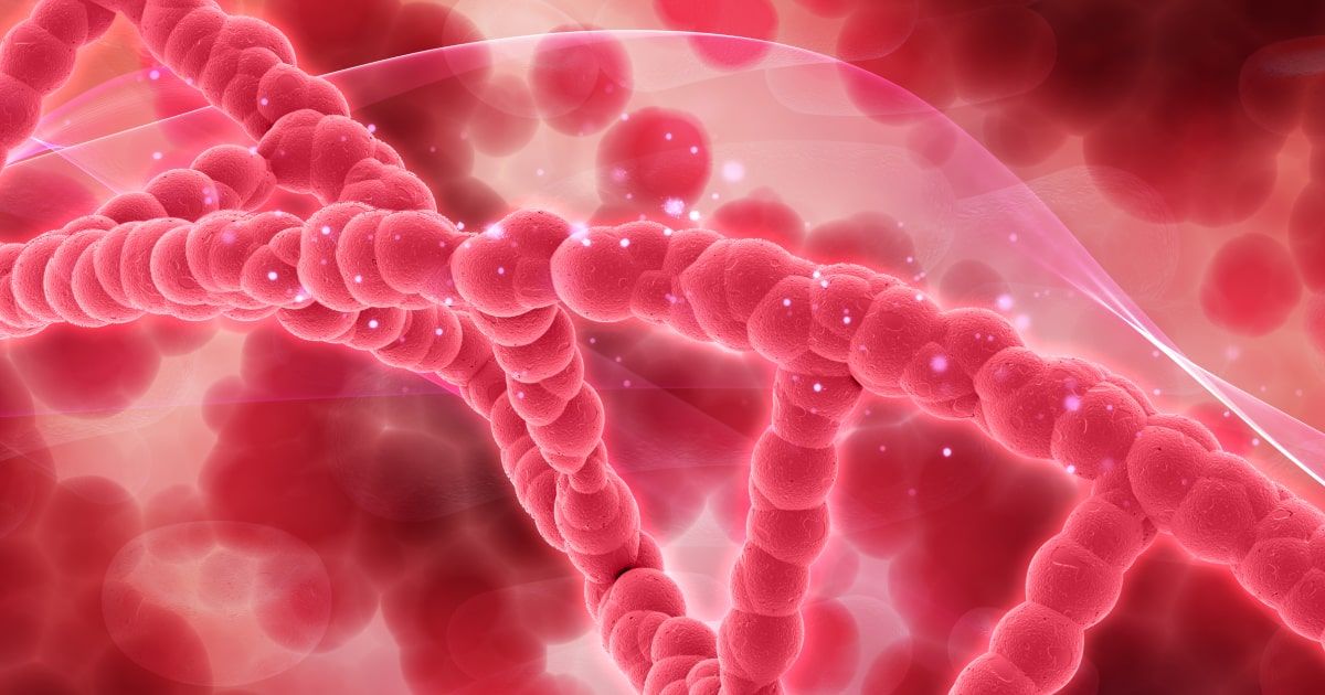 Acute myeloid leukemia
