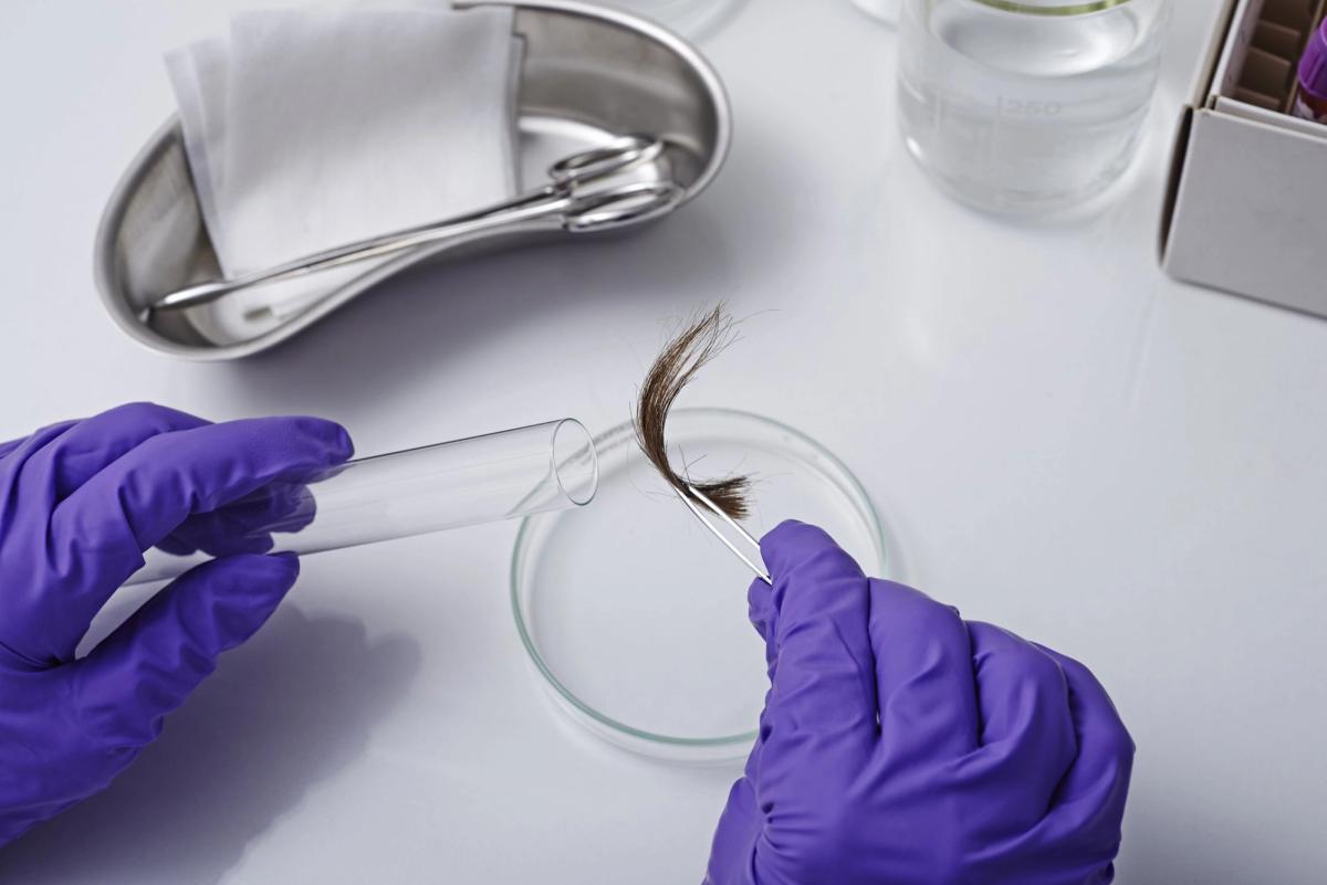 5 Things You Need to Know About Hair DNA Tests