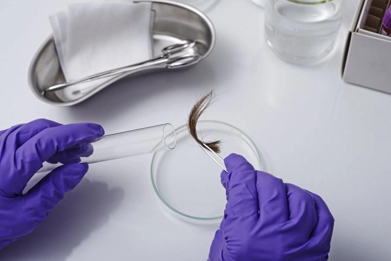 5 Things You Need to Know About Hair DNA Tests