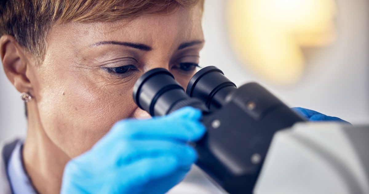 Acute myeloid leukemia with multilineage dysplasia