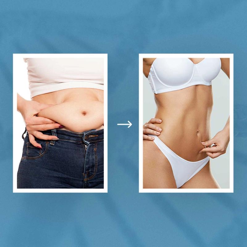 what does dna have to do with weight loss